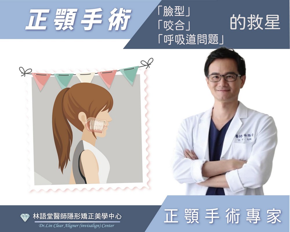 正顎手術能改變什麼?