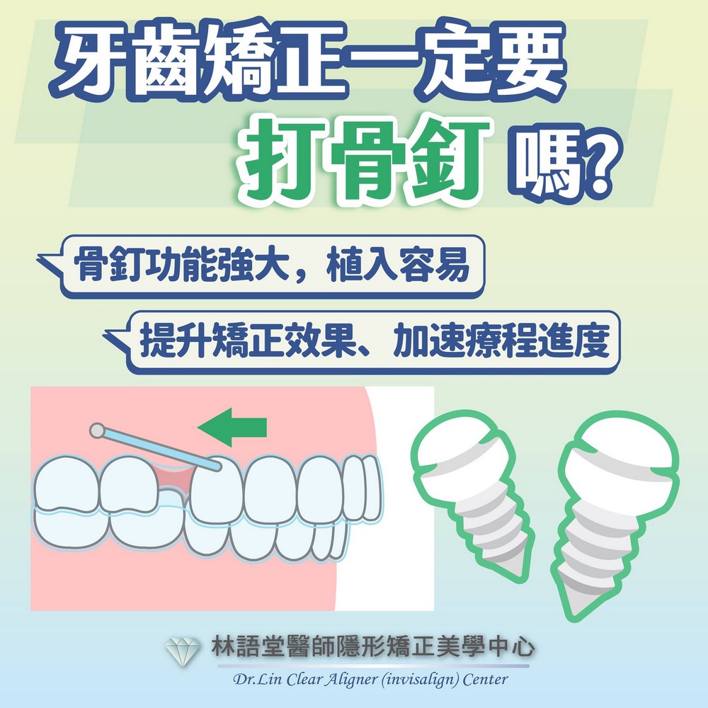 矯正一定要打骨釘嗎?