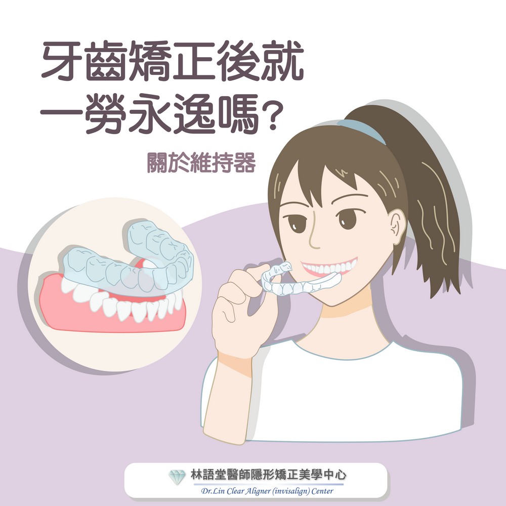 什麼是二次矯正？關於維持器看這篇
