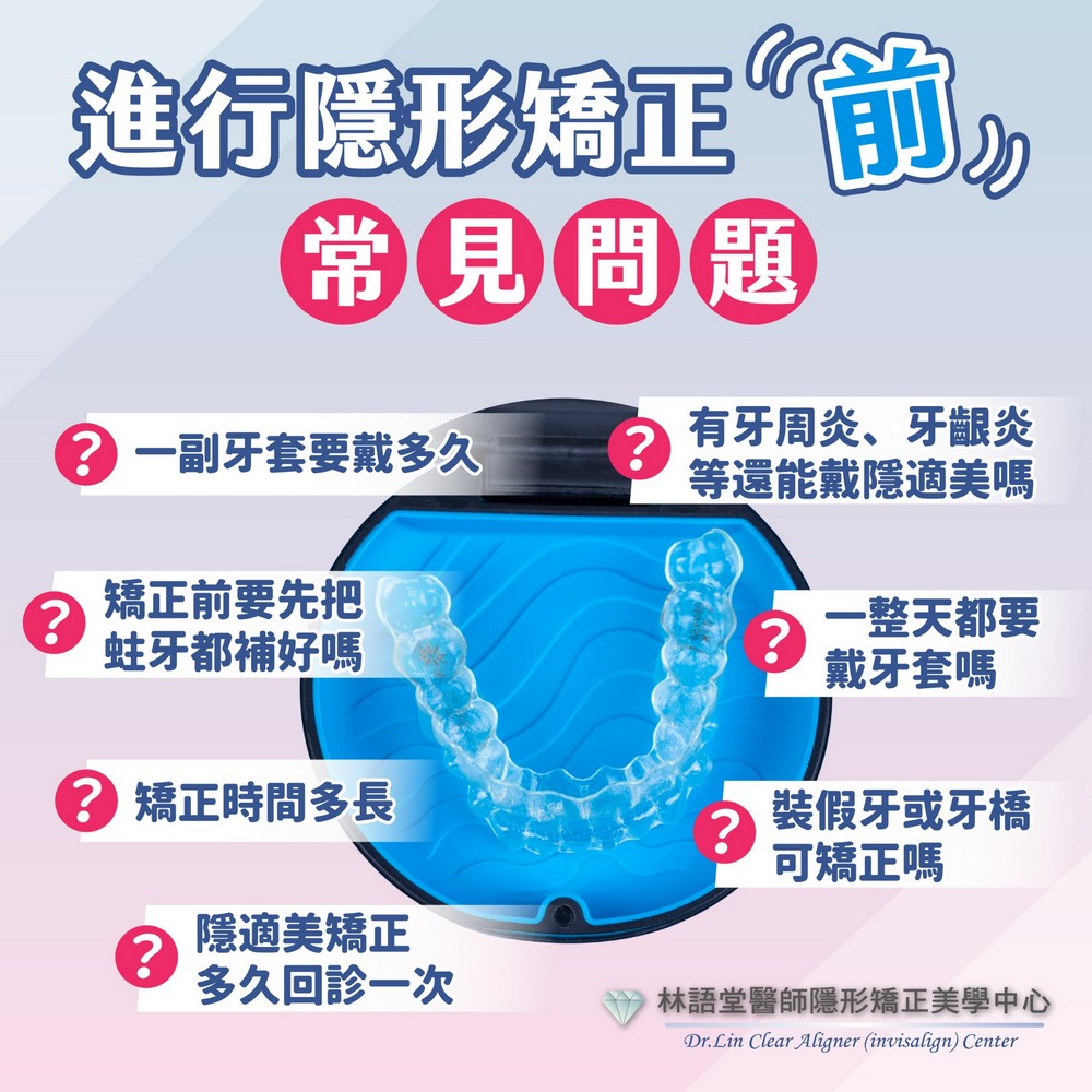 進行隱形矯正「前」常見問題