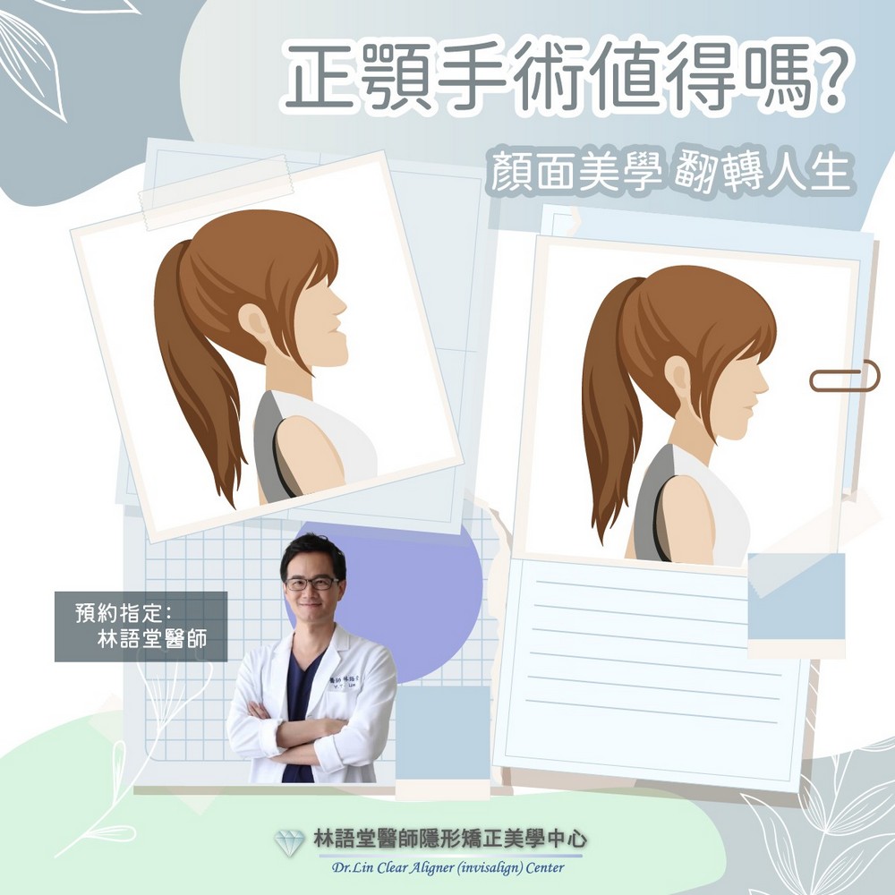 正顎手術 真的值得嗎？