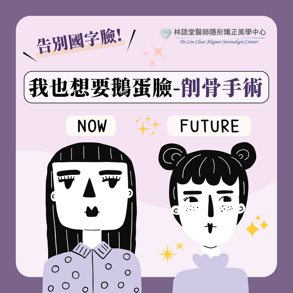 Oh No！我也想要鵝蛋臉-削骨手術 告別國字臉