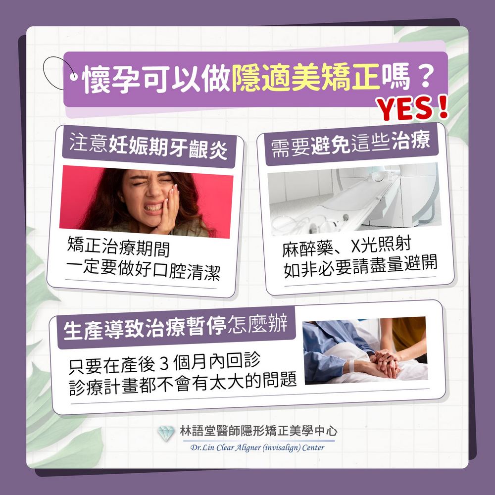 懷孕可以做隱適美矯正嗎？ 孕媽咪一定要注意！